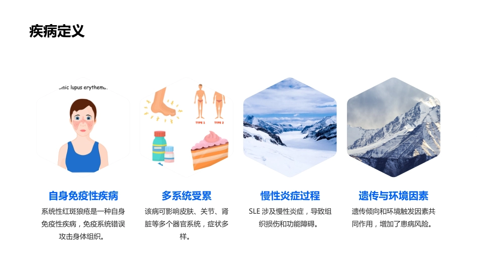 系统性红斑狼疮教学ppt课件_第4页