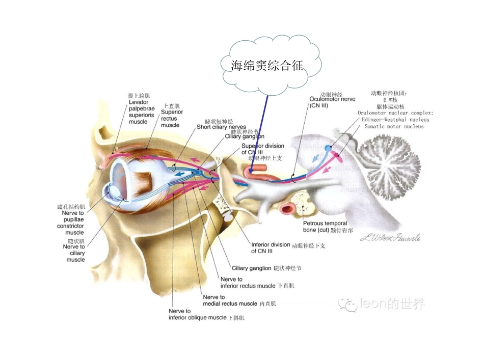 动眼神经麻痹一例_第11页