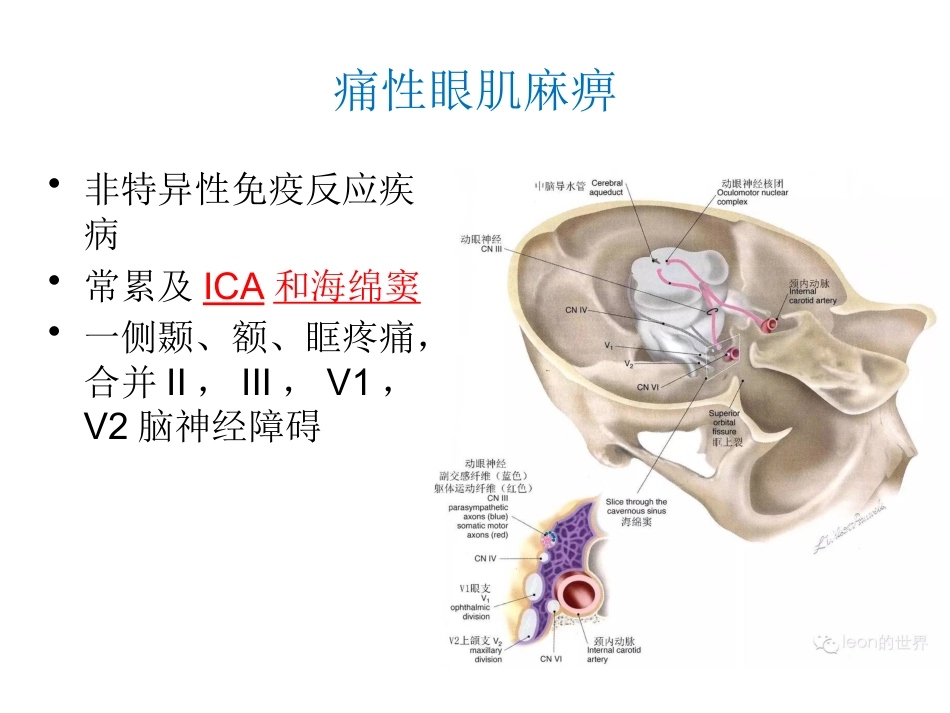 动眼神经麻痹一例_第12页