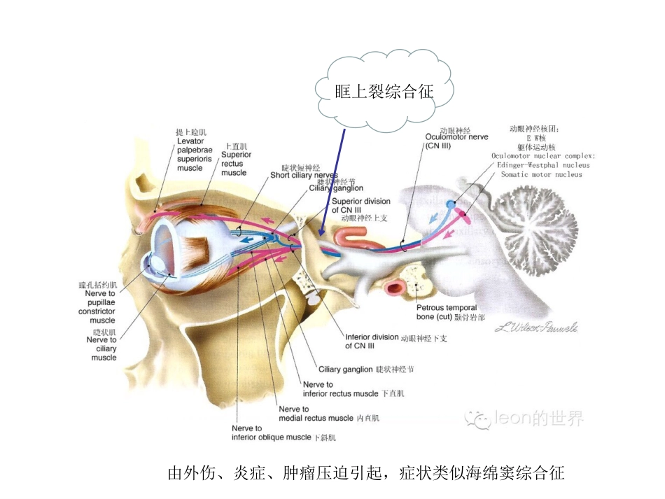 动眼神经麻痹一例_第13页