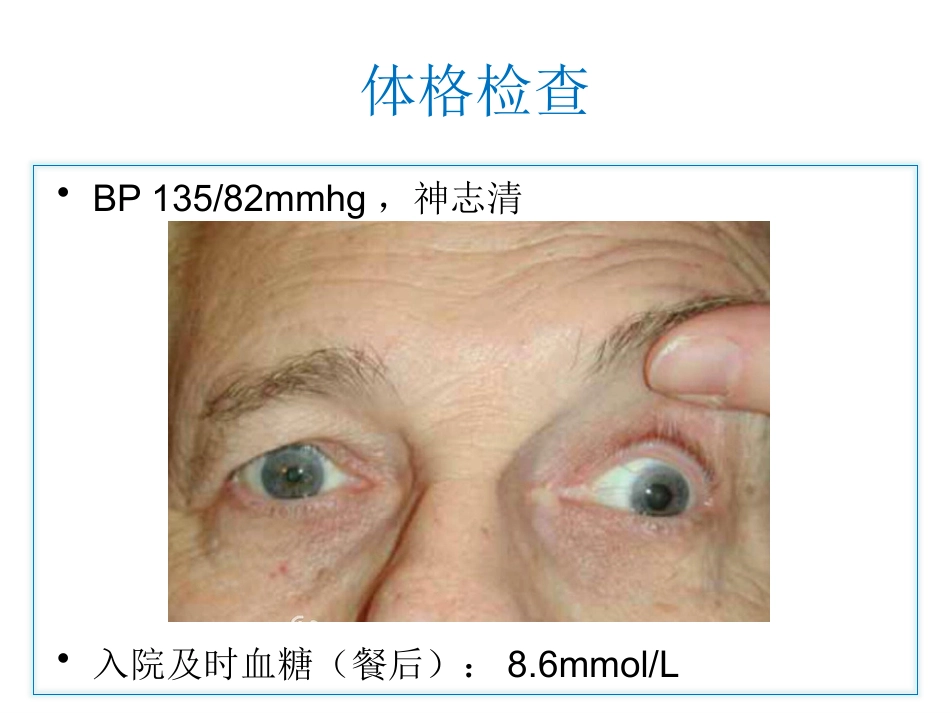 动眼神经麻痹一例_第4页
