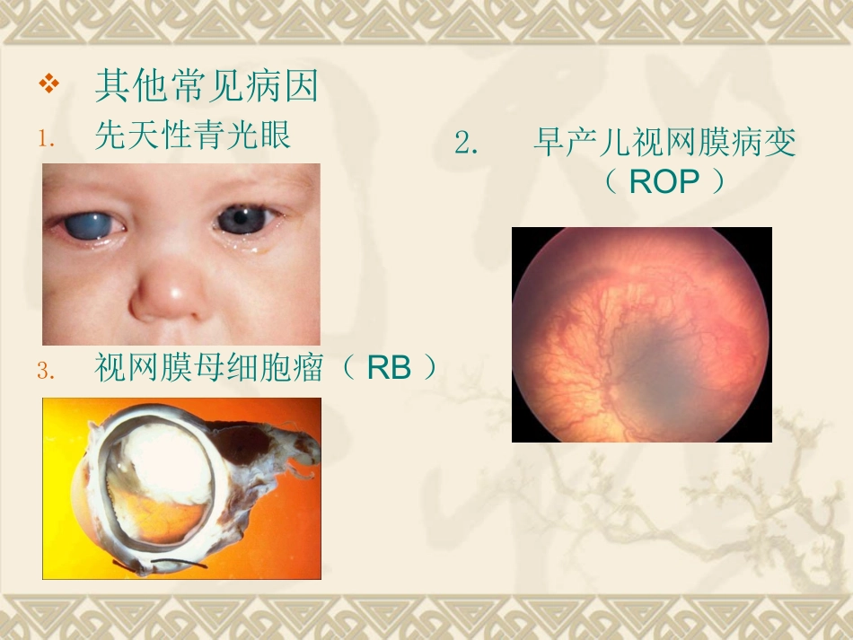 儿童低视力_第6页
