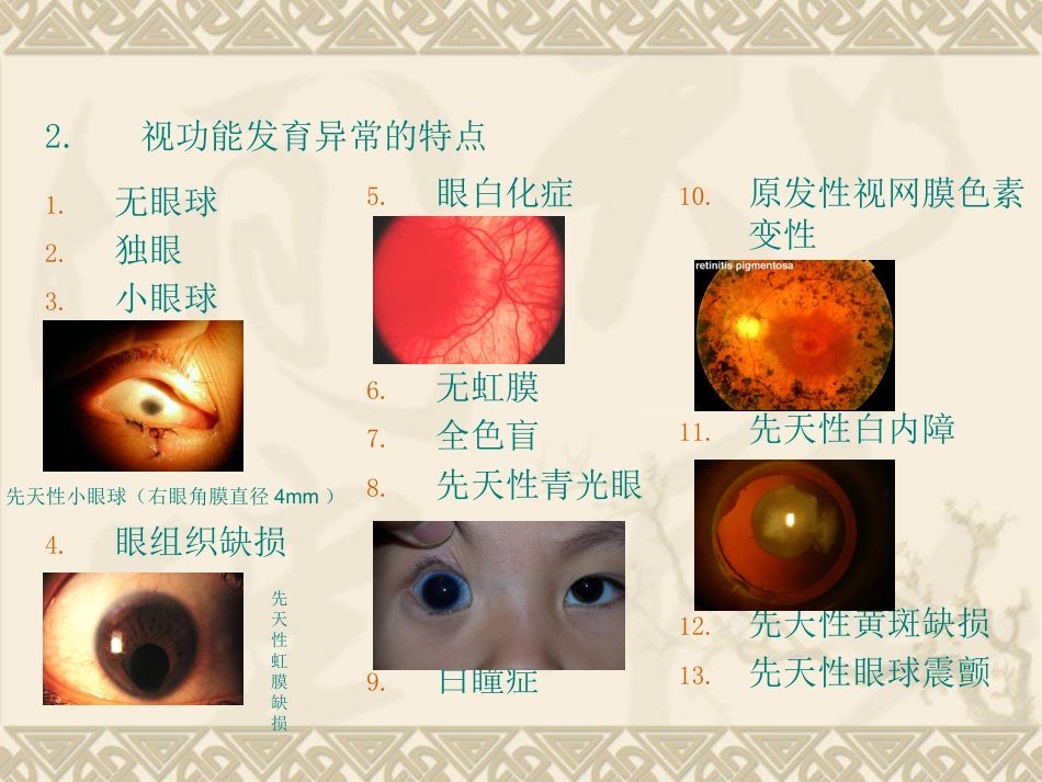 儿童低视力_第9页