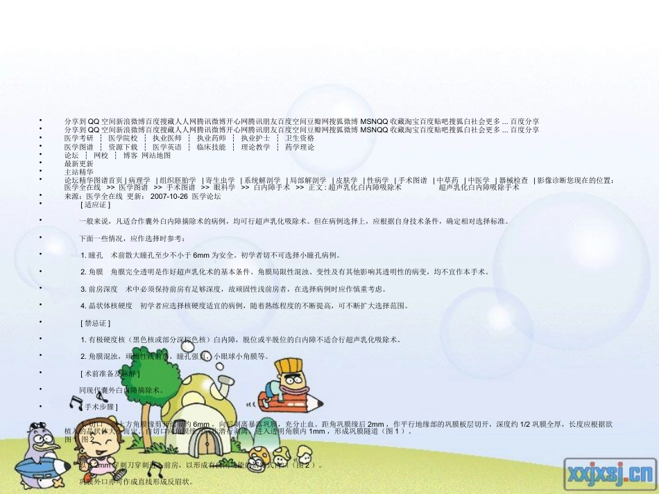白内障超声乳化+_第2页