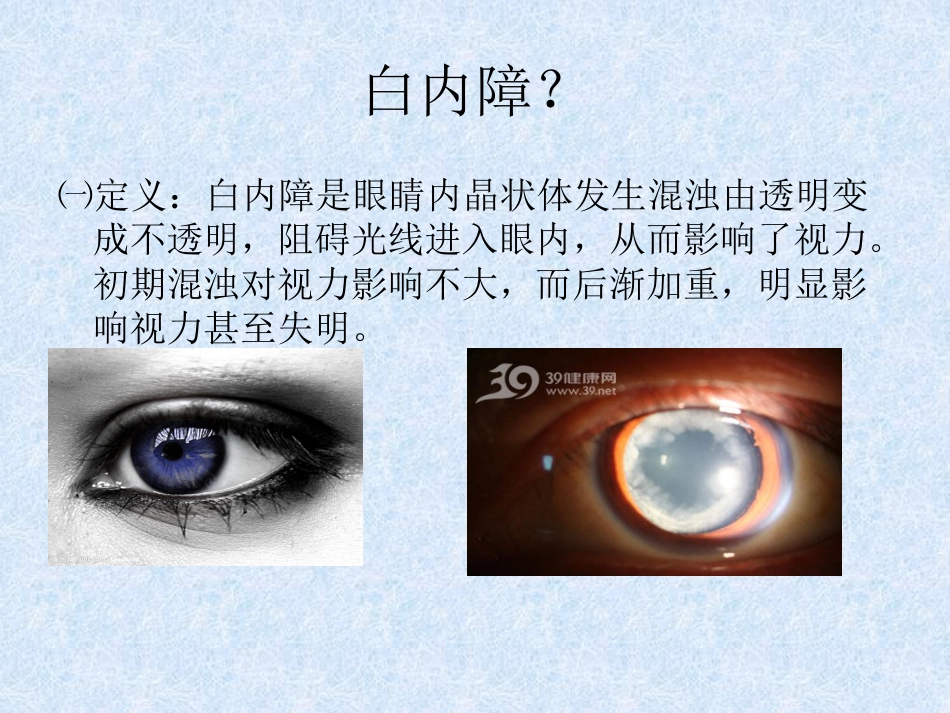 白内障超声乳化+_第4页