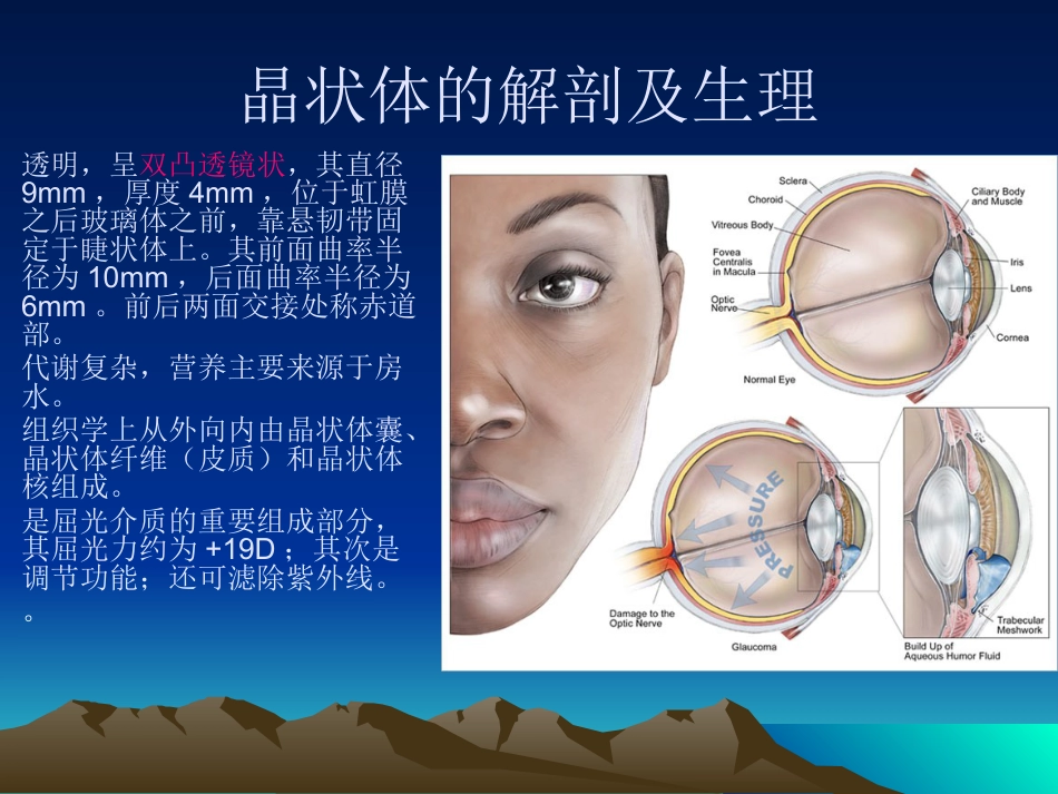 白内障课件_第2页