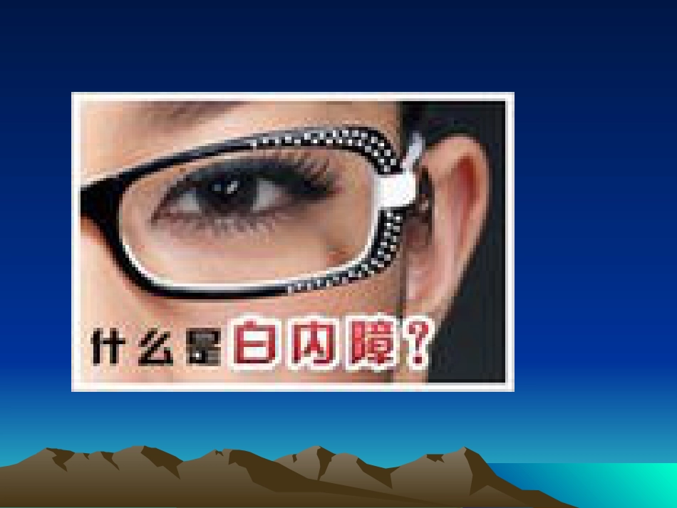 白内障课件_第5页
