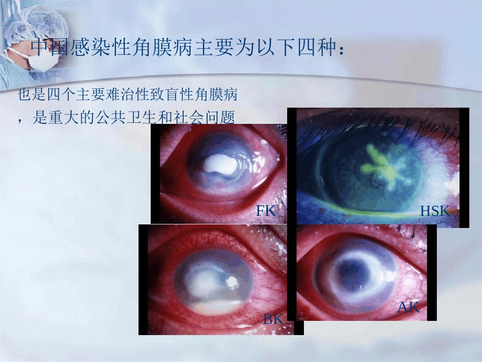 病毒性角膜炎课件_第2页
