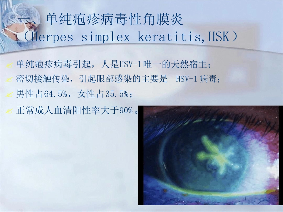 病毒性角膜炎课件_第4页