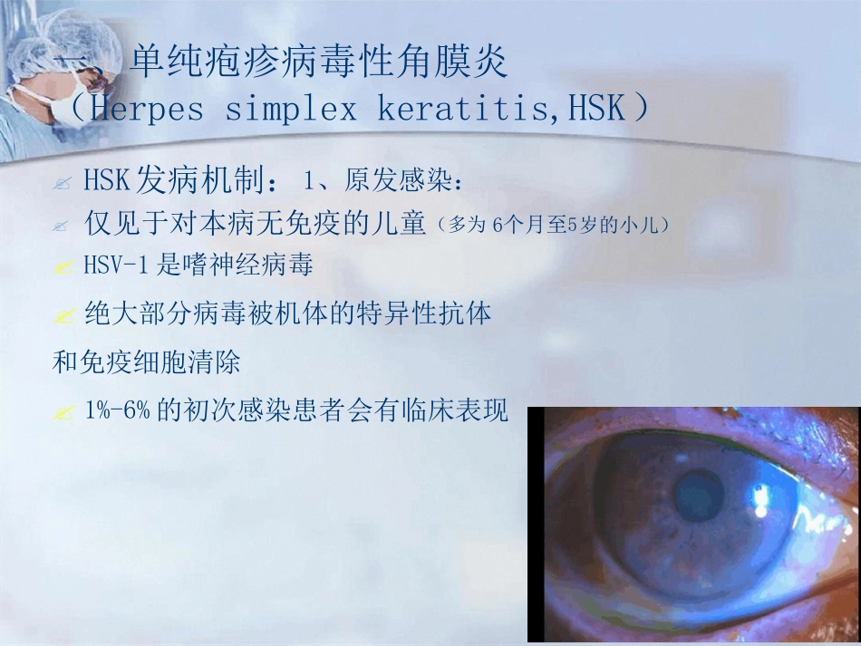 病毒性角膜炎课件_第6页