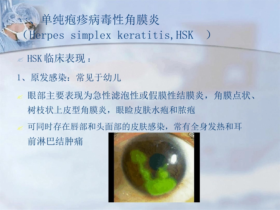 病毒性角膜炎课件_第9页