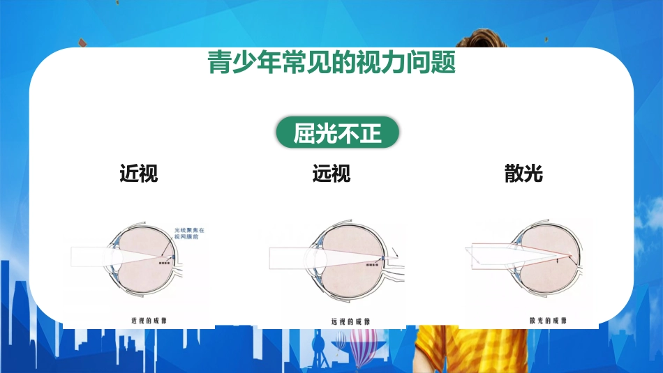 儿童卡通保护眼睛预防近视PPT_第10页