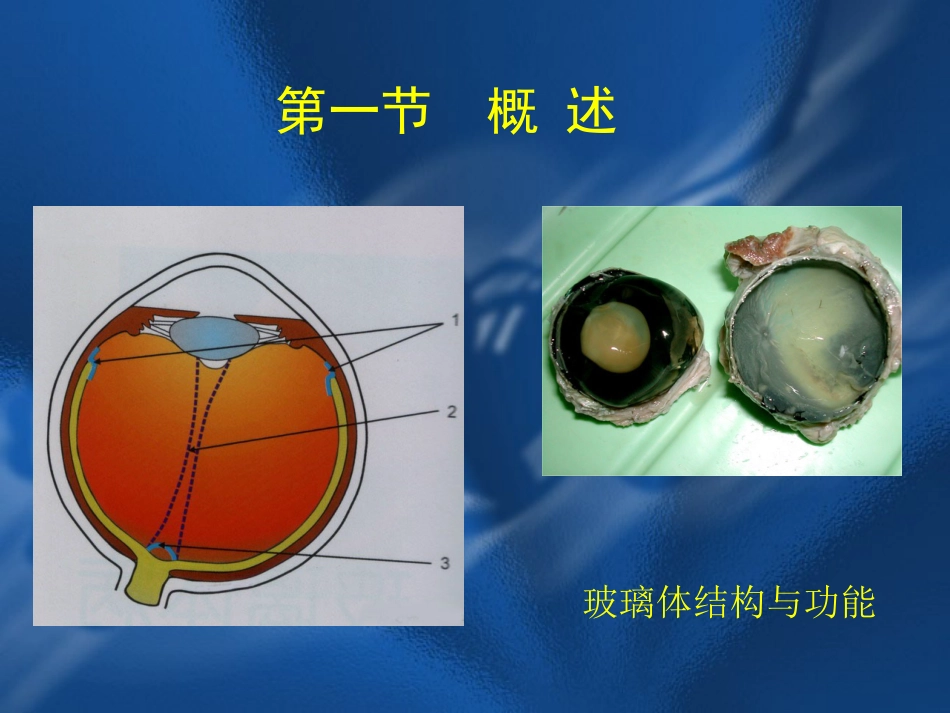 玻璃体疾病 PPT_第2页