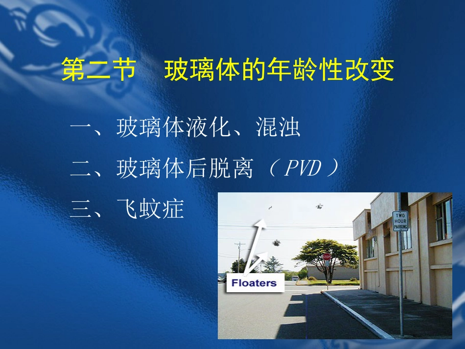 玻璃体疾病 PPT_第5页
