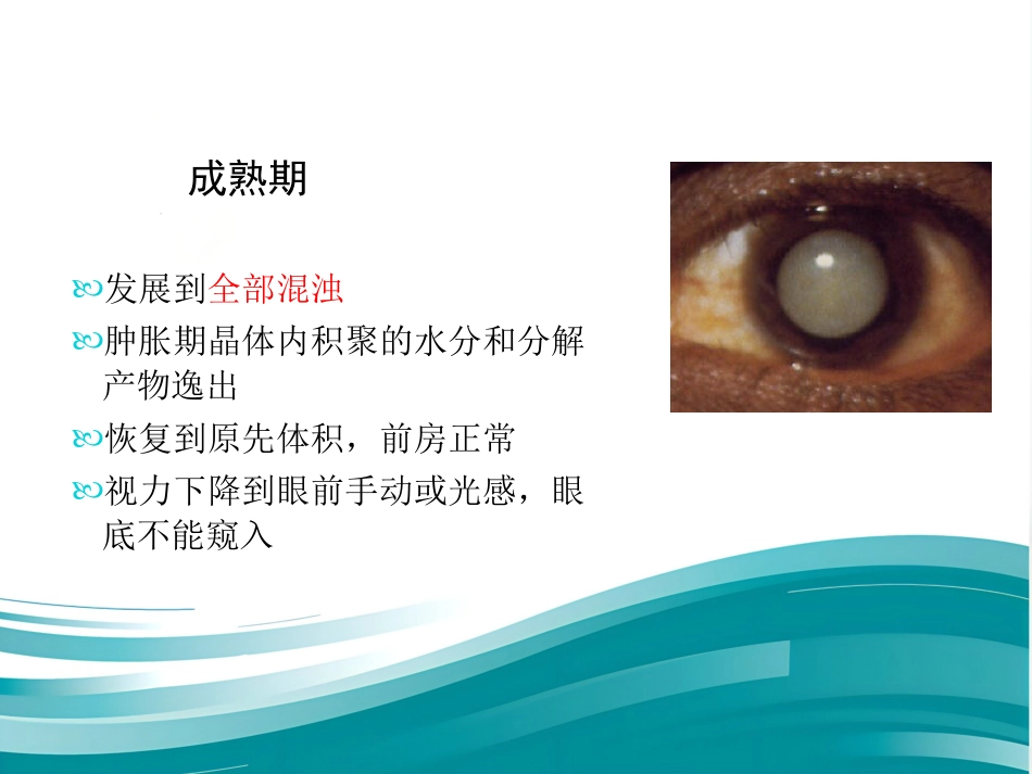 白内障和IOL计算 _第12页