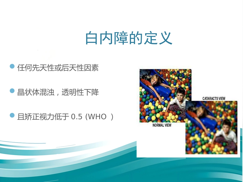 白内障和IOL计算 _第2页