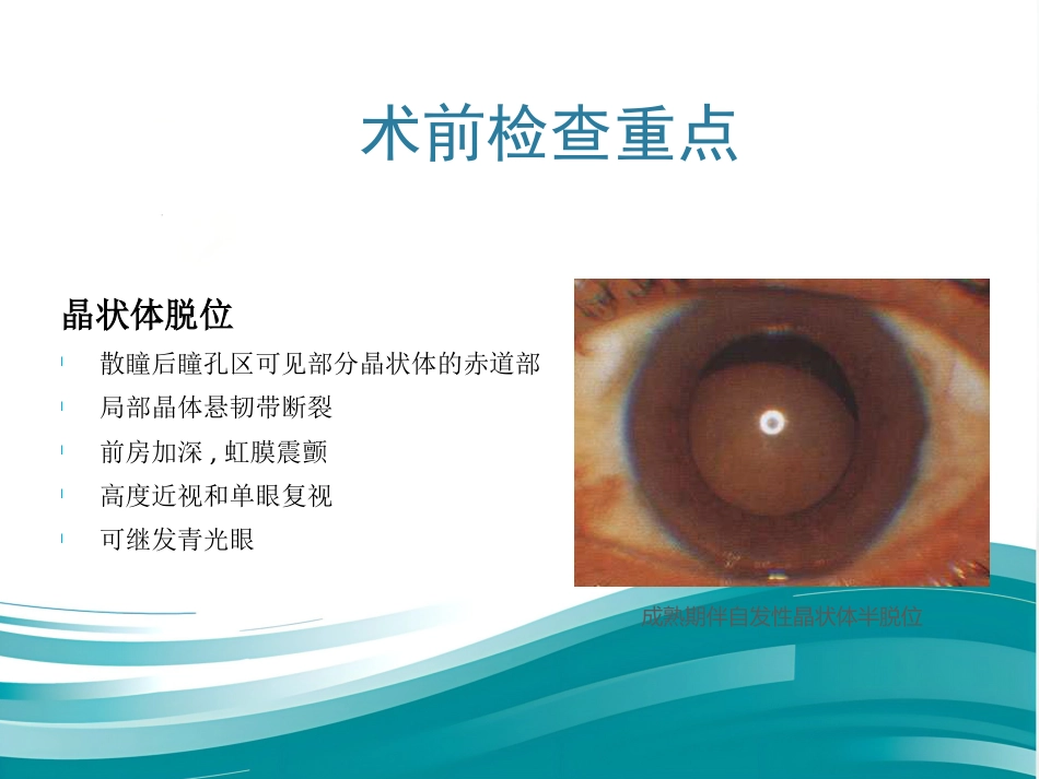 白内障和IOL计算 _第8页