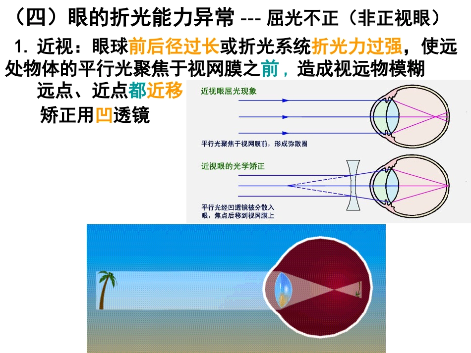 《眼的视觉功能》_第13页