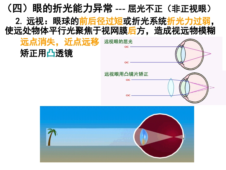 《眼的视觉功能》_第14页