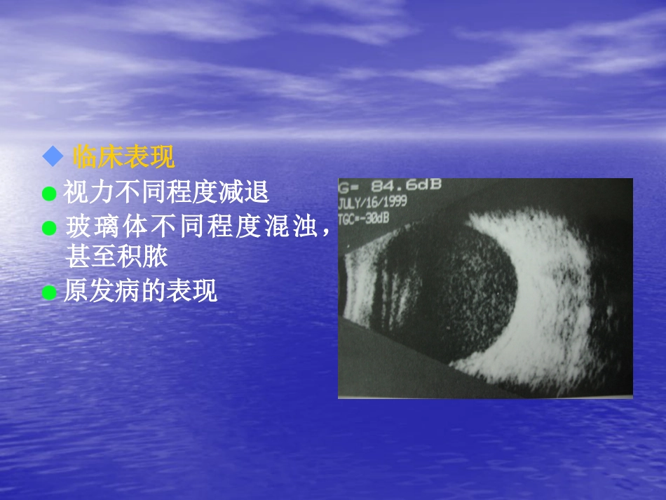 玻璃体疾病_第13页