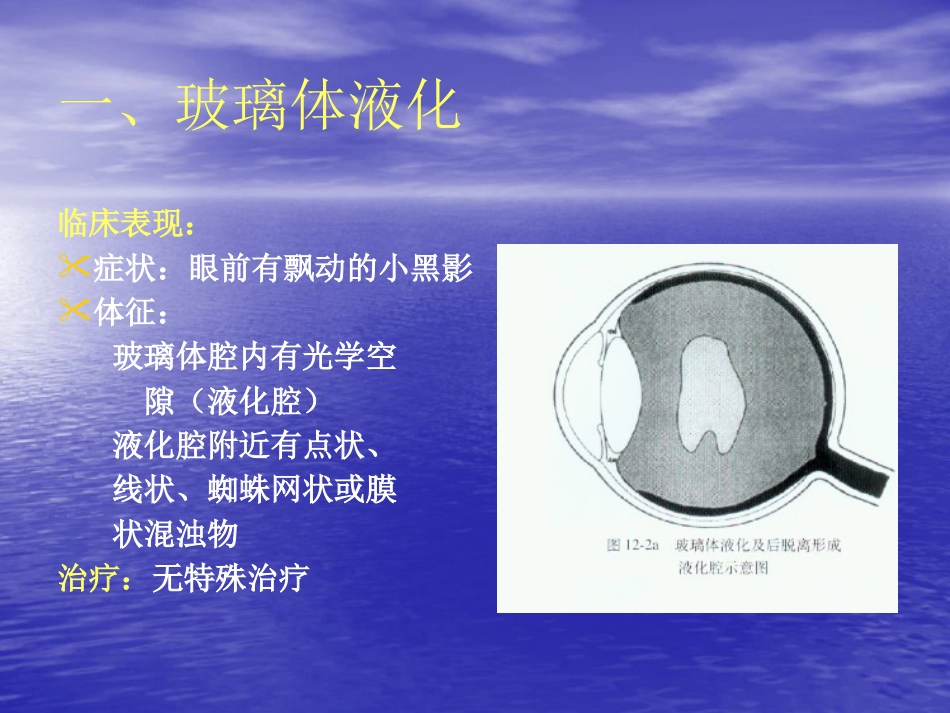 玻璃体疾病_第3页