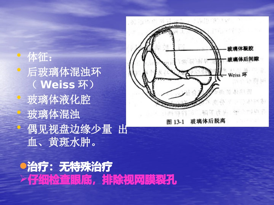 玻璃体疾病_第5页