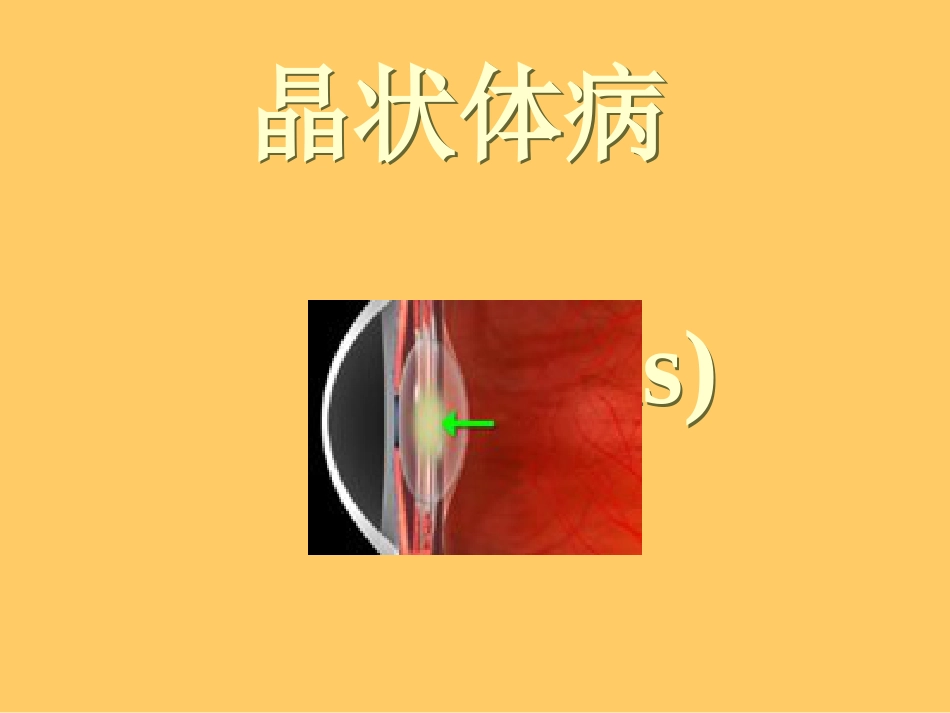 白内障晶体PPT医学课件_第1页