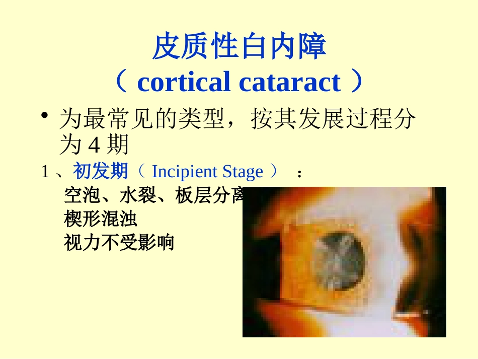 白内障晶体PPT医学课件_第11页