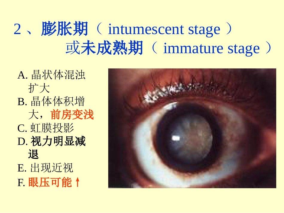 白内障晶体PPT医学课件_第12页