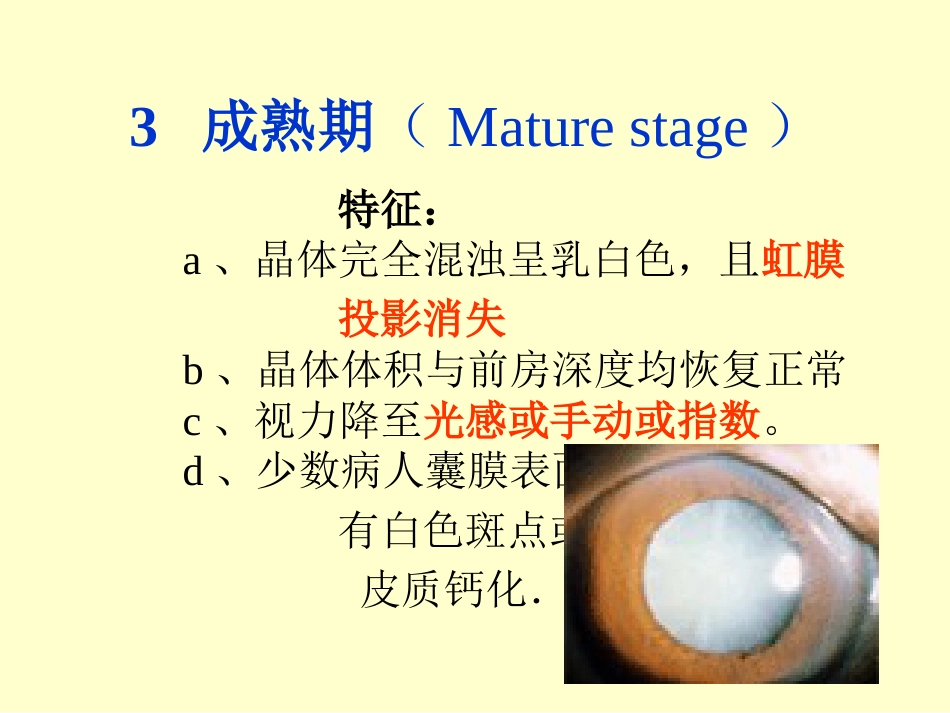 白内障晶体PPT医学课件_第13页