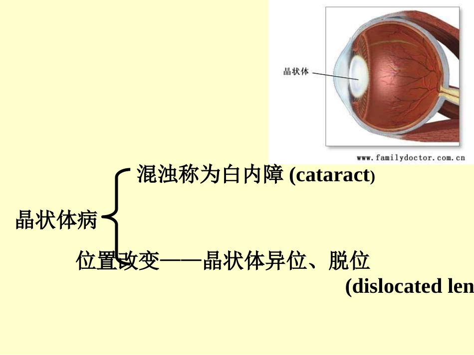 白内障晶体PPT医学课件_第2页