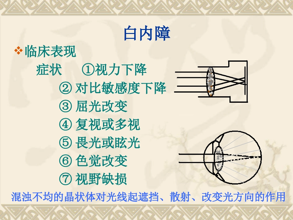 白内障的临床表现、诊断与治疗_第10页