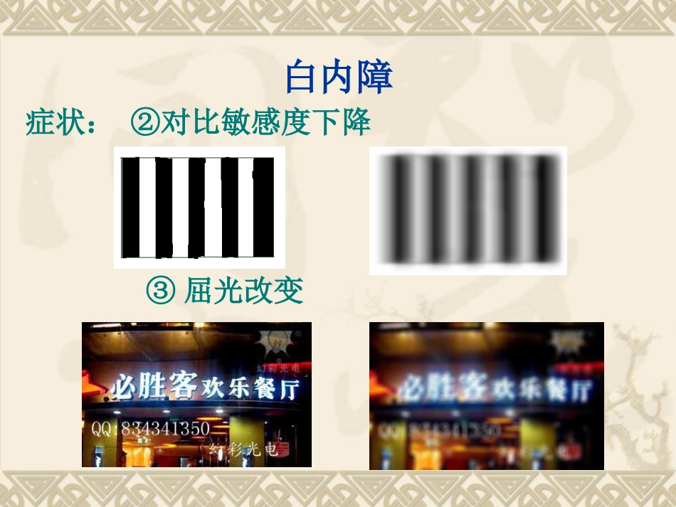白内障的临床表现、诊断与治疗_第12页