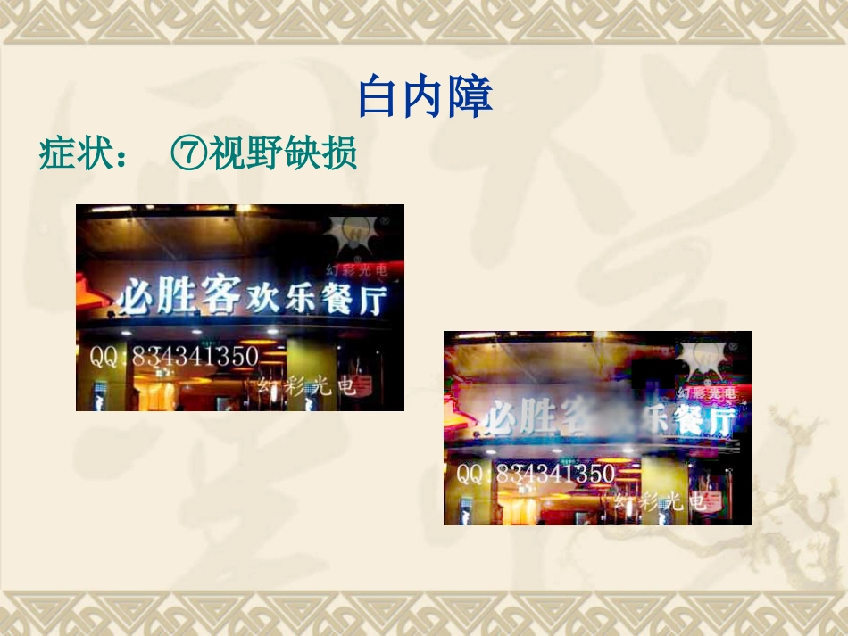 白内障的临床表现、诊断与治疗_第14页