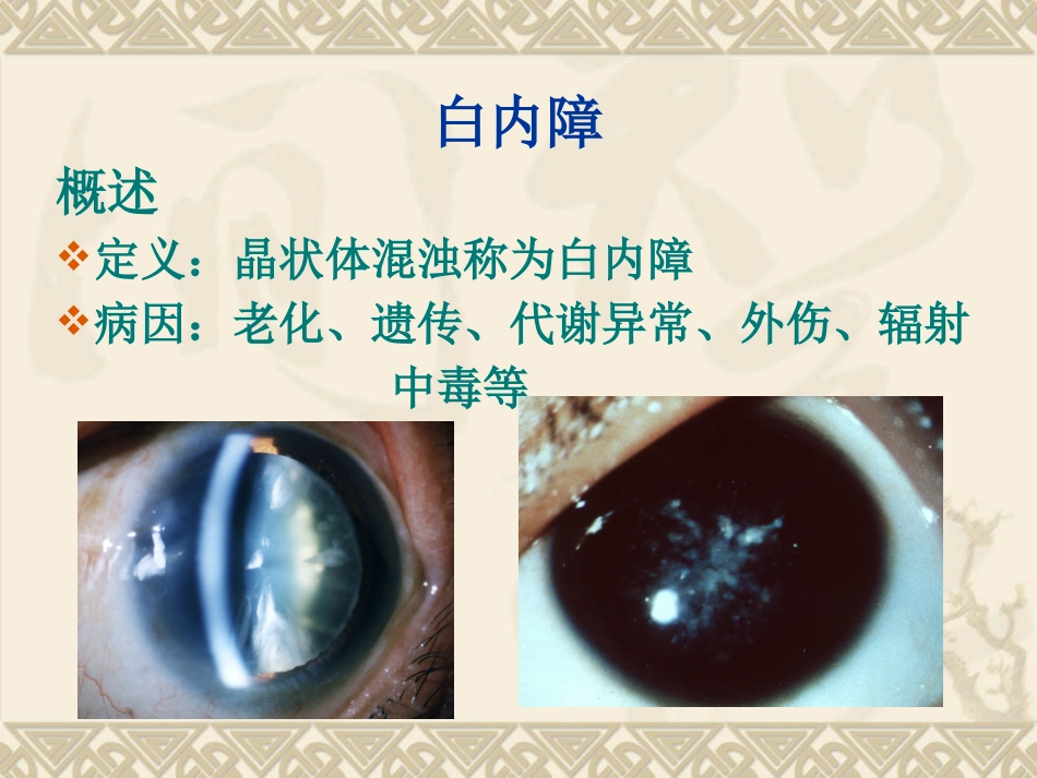 白内障的临床表现、诊断与治疗_第7页