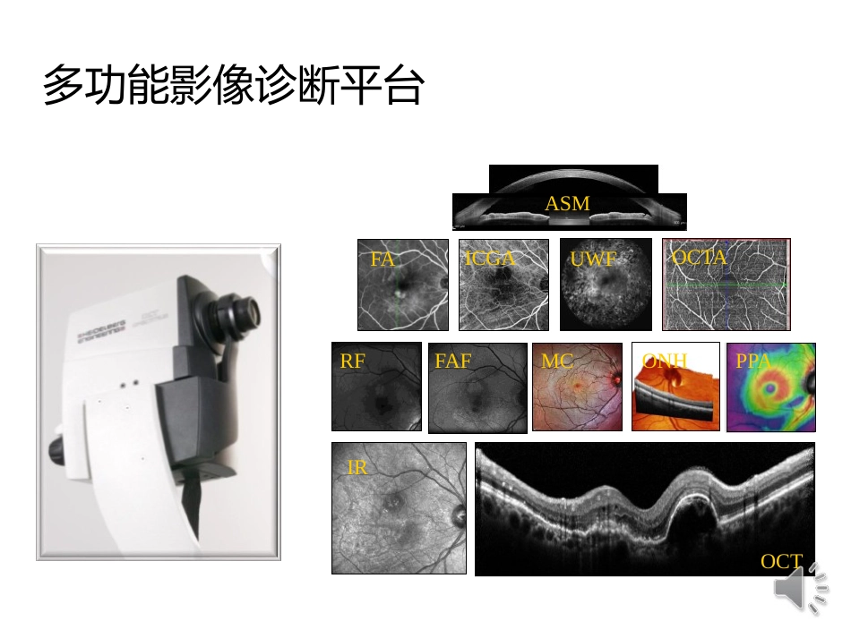 病理性近视CNV的诊断与治疗进展_第15页