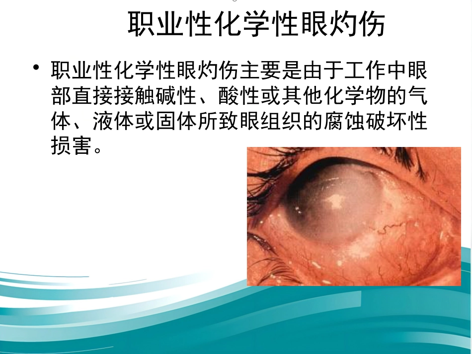 《职业性眼病》_第3页