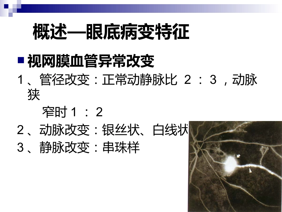 《视网膜病》_第13页
