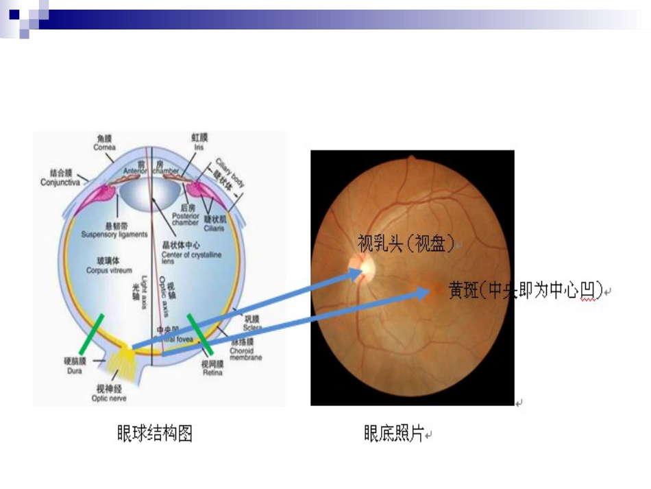 《视网膜病》_第2页