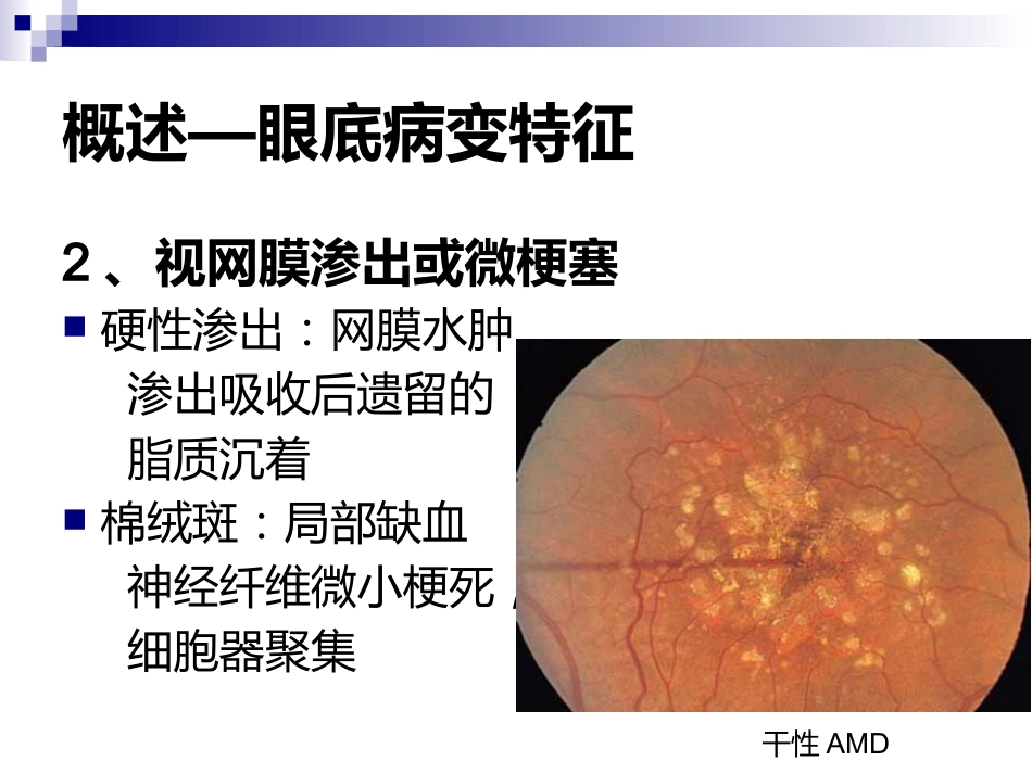 《视网膜病》_第9页