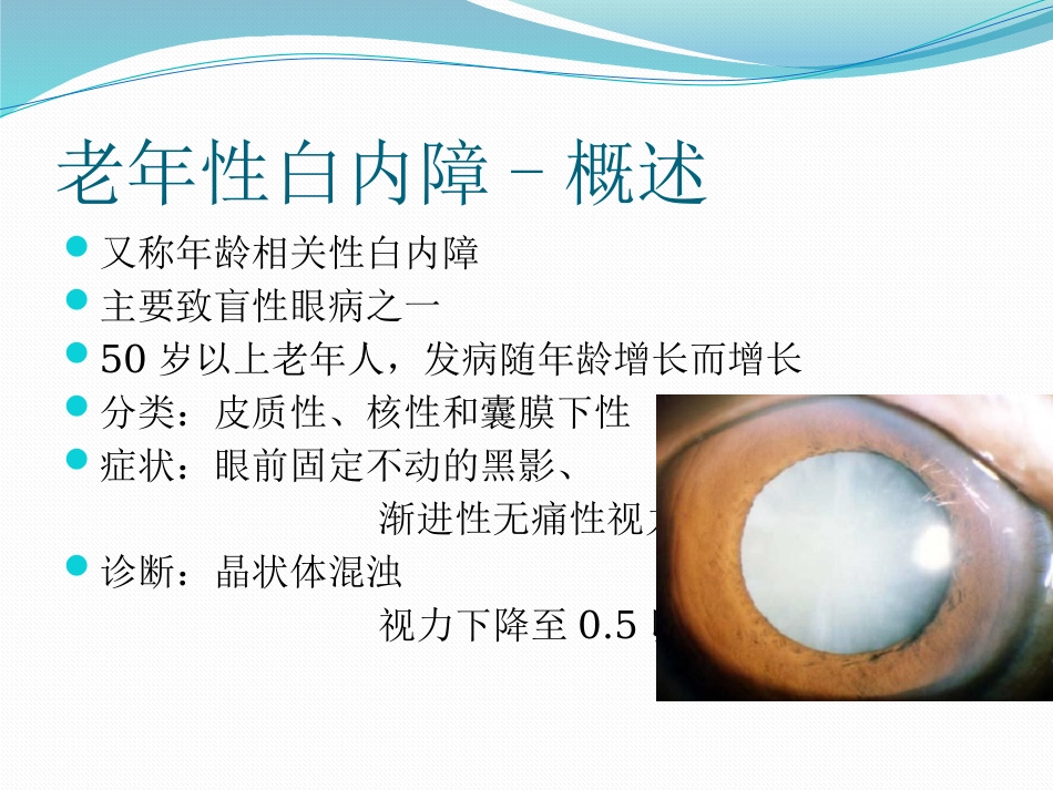 白内障的诊断与治疗_第3页