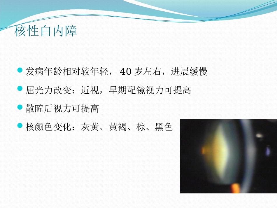 白内障的诊断与治疗_第8页