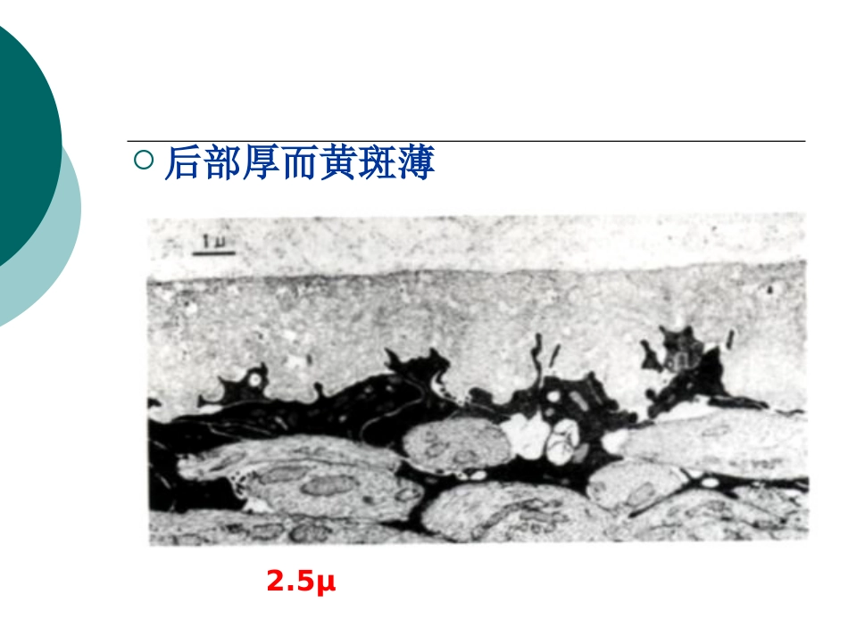 玻璃体病基础与临床_第13页