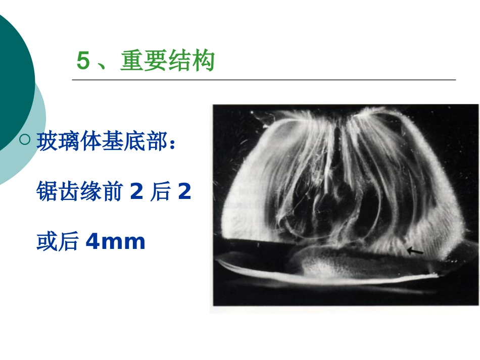 玻璃体病基础与临床_第8页