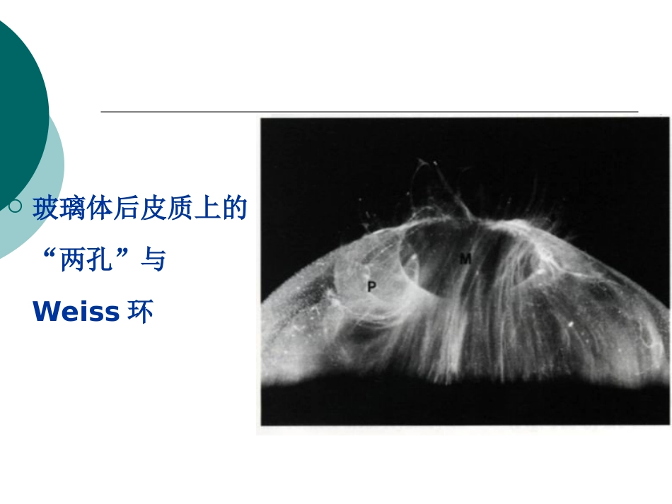 玻璃体病基础与临床_第9页
