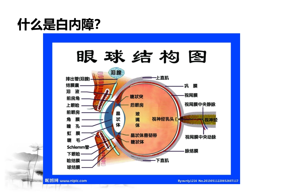 白内障疾病认识与治疗_第4页