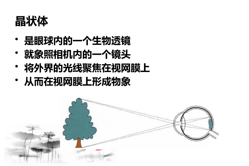 白内障疾病认识与治疗_第5页