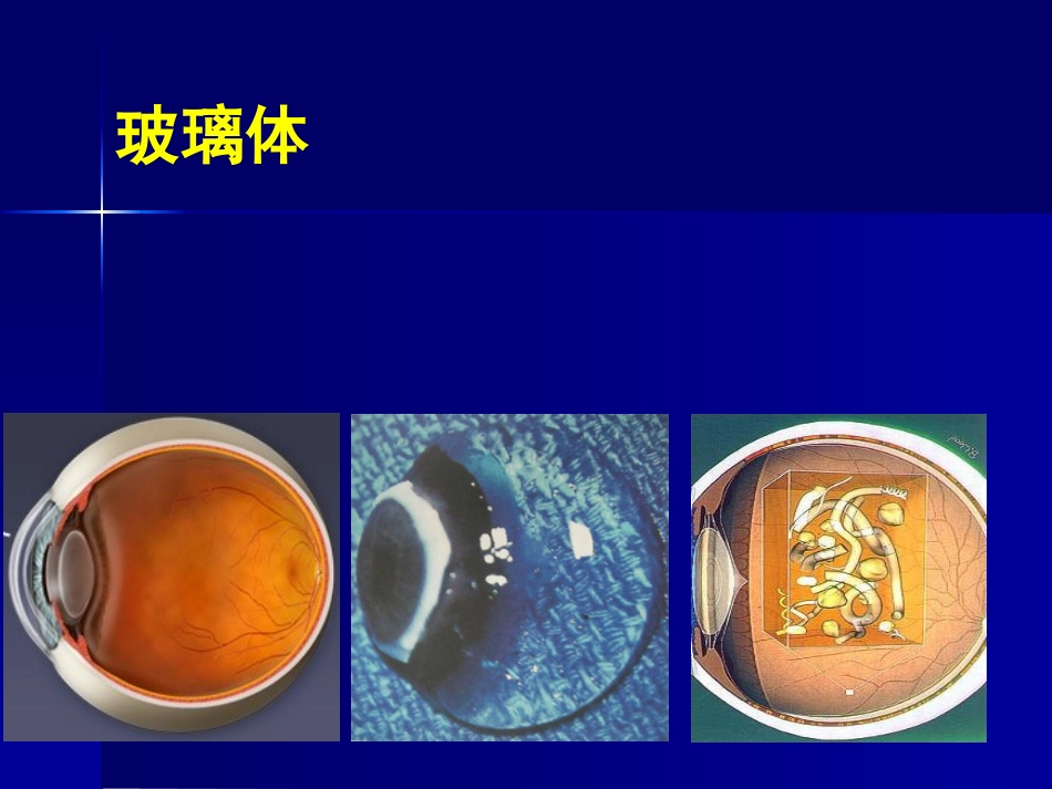 玻璃体 视网膜疾病_第3页