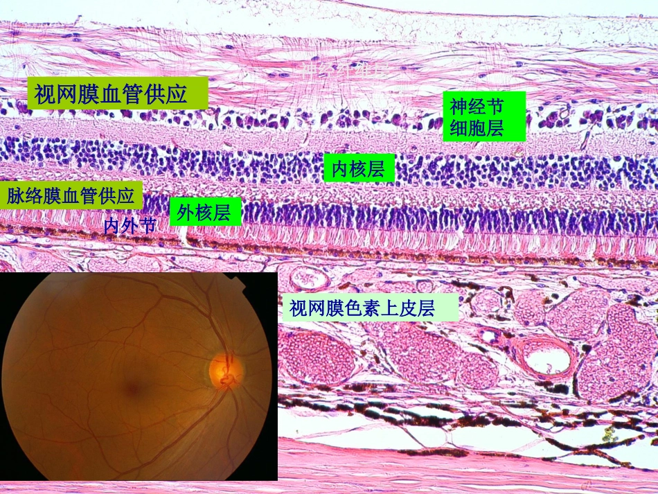 玻璃体 视网膜疾病_第5页