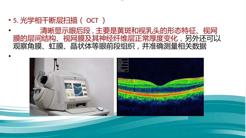 常见眼底病基础知识_第12页